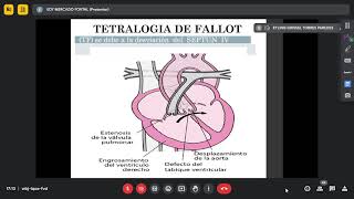 Cardiopatías congénitas cianóticas Dr m2024 01 25 [upl. by Ylaek271]