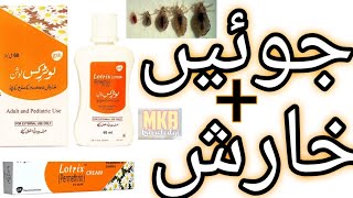 The SHOCKING Truth About Lotrix Lotion Urdu [upl. by Luelle]