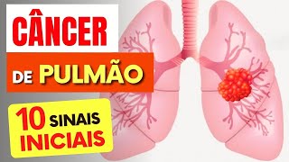 10 SINAIS de Alerta para CÂNCER de PULMÃO que Todos Deveriam Saber [upl. by Travus]