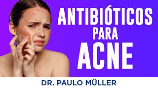 Antibióticos para Acne – Dr Paulo Müller Dermatologista [upl. by Helm979]