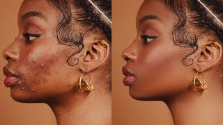 HighEnd Skin Retouching Beginner Photoshop Tutorial  Frequency Separation [upl. by Geldens]