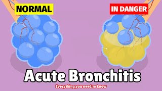 What is Acute Bronchitis  Causes Symptoms Diagnosis amp Treatment [upl. by Ineslta]