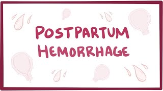 Postpartum hemorrhage  causes symptoms diagnosis treatment pathology [upl. by Ahsiekin]