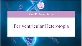 What is Periventricular Heterotopia [upl. by Arammahs691]