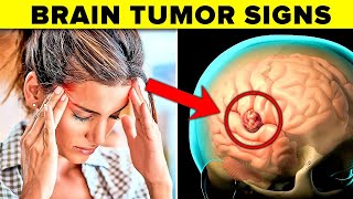 9 Warning Signs Of A Brain Tumor IMPORTANT [upl. by Kiri182]