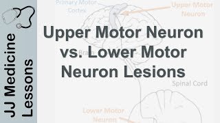 Upper and Lower Motor Neuron Lesions  UMN vs LMN Differences and Mnemonic [upl. by Ivor483]