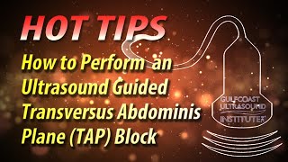 How to perform an ultrasound guided transversus abdominis plane TAP block [upl. by Eniahpets793]