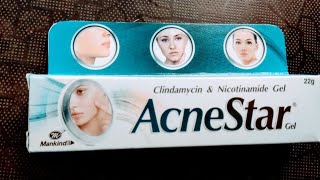 AcneStar review in ಕನ್ನಡ  review on AcneStar gel acnestar pimplecream kannadavlog acnegel tip [upl. by Rosalind197]