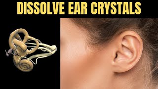 How to Dissolve Crystals in the Inner Ear and Get Rid of Vertigo [upl. by Rahas801]