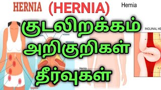 Hernia symptoms in tamilhernia symptoms for men hernia treatment in tamilhernia in tamil [upl. by Linsk]