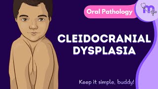 Cleidocranial Dysplasia  Features  Oral Manifestation  Treatment  Oral Pathology  Animated [upl. by Nuncia]