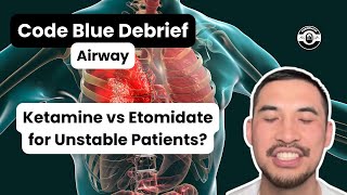 Ketamine vs Etomidate for Unstable Patients  Rapid Sequence Intubation  CodeBlueDebrief [upl. by Arnoldo]