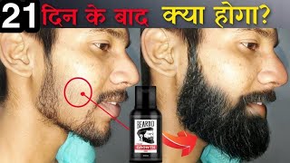 Beardo Hair Growth Oil After 21 Days Review  Best Beard Oil For Patchy Beard in India 2023 [upl. by Golden]