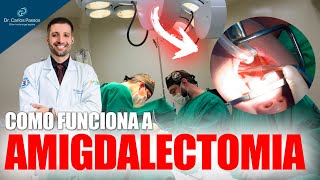 Como funciona a AMIGDALECTOMIA  TUDO SOBRE A CIRURGIA DAS AMÍGDALAS [upl. by Deadman]