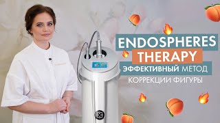 Корекція фігури  Endospheres therapy [upl. by Annola]