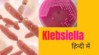 Klebsiella morphology pathogenesis lab diagnosis amp treatment in hindi [upl. by Auberon410]