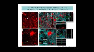 The spread of mutant huntingtin protein from cell to cell and its implications for [upl. by Nwahsit]