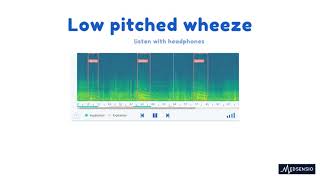 Lung sounds  low pitched wheeze [upl. by Fortier]