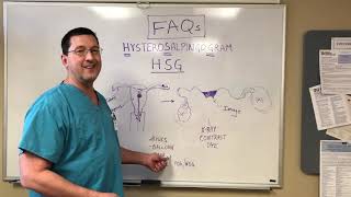 Just the FAQs The HSG Hysterosalpingogram [upl. by Aryek]