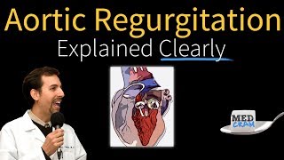 Aortic Regurgitation Insufficiency Explained Clearly [upl. by Nirel]