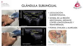 Ecografía Glándulas salivales Dra Mendieta Parte III [upl. by Ellard]