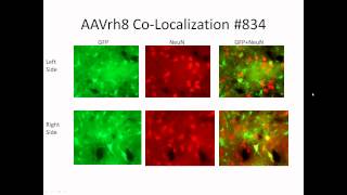 Research Webinar Gene Silencing approaches for HD [upl. by Hieronymus]