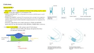 NSTEMI angiographic and PCI tips [upl. by England414]