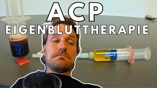 ACP Eigenbluttherapie für die Patellasehne  die erste Sitzung [upl. by Loredana]