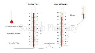 ESR Test  Erythrocyte Sedimentation Rate  ESR Determination  Erythrocyte Sedimentation Test [upl. by Cyrill]