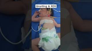 GRUNTING amp RDS NEW BORNNewBorn grunting shorts love pediatrics [upl. by Eirlav]