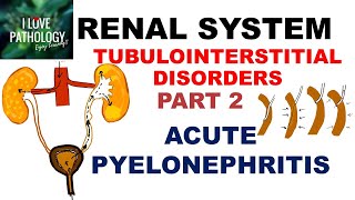 ACUTE PYELONEPHRITIS Pathology [upl. by Agatha]