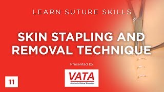 Skin Stapling and Removal Technique  Learn Suture Techniques  VATA [upl. by Boone]