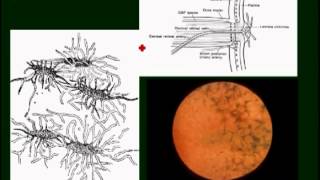 neuroophthalmology pt4 [upl. by Levenson]