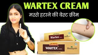 मस्से सूखकर झड़ जायेगे  मस्से हटाने की सबसे असरदार क्रीम  wartex Cream uses in hindi [upl. by Allain177]