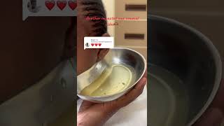 Impacted ear wax removal video Please don’t forget to subscribe like and share fyp Audiologist [upl. by Emearg381]