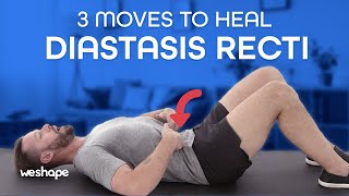 3 Moves To Heal Diastasis Recti [upl. by Willey]