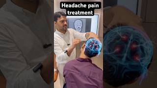 Headache pain and cervical pain treatment feed ytshort trend shortfeed [upl. by Hecht]