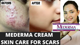 Mederma Cream Review And Uses In Hindi  दाग मिटाने की सबसे अच्छी क्रीम  mederma scars cream [upl. by Hubbard]