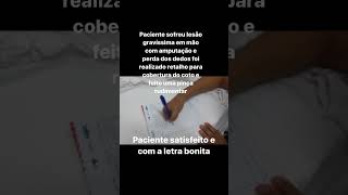 Amputação da mão e dos dedos com explosão  Paciente recuperado e satisfeito com o pouco que tem [upl. by Hope]