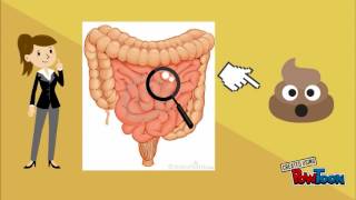 Ciclo de vida de strongyloides stercoralis [upl. by Bazar237]