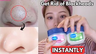 How I INSTANTLY Removed My Blackheads with VASELINE [upl. by Andee]