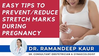 How to get rid of stretch marks  Dr Hansaji Yogendra [upl. by Stacia87]