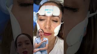 EMFACE  lo último en rejuvenecimiento facial 👩🏻‍⚕️✨ [upl. by Graner]