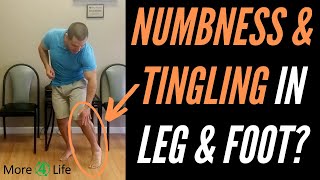 Numbness and Tingling In Leg and Foot [upl. by Atena]