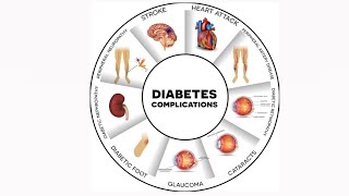 Complications of DM Uptodate simple as simple [upl. by Odnalo]