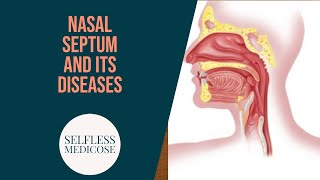 NASAL SEPTUM and DISEASES part 3 DEVIATED NASAL SEPTUM very important topic with all details [upl. by Lekram]