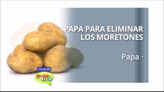 Papa para eliminar moretones [upl. by Estele579]