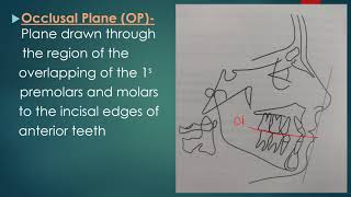 Cephalometric Planes [upl. by Yntruoc]