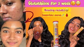 Glutathione ഇത്രയും റിസൾട്ട്‌ തരുമെന്ന് പ്രതീക്ഷിച്ചില്ല 😳💯🙌 2 week experience 🤩🌟 [upl. by Nej]