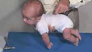 Neurology Exam 3 Month Primitive ReflexesGalant [upl. by Yecram]